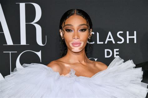 winnie harlow net worth|Winnie Harlow Net Worth 2024: What Is The Model。